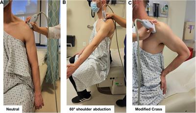 Reliability of point-of-care shoulder ultrasound measurements for subacromial impingement in asymptomatic participants